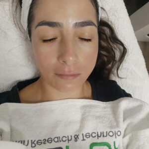 גילה ואקנין טיפולי פנים
