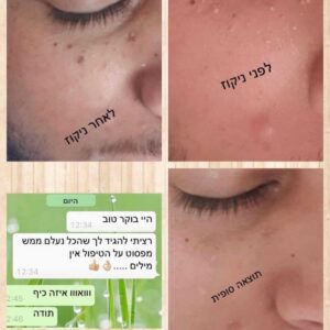 נורית-1.jpeg